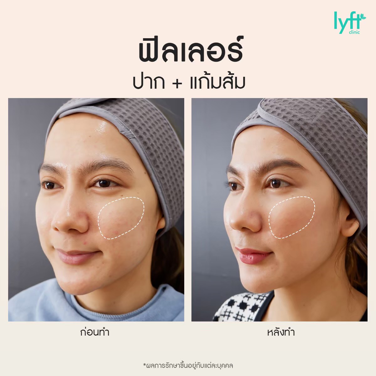 LINE_ALBUM_????มีนาคม????_๒๓๐๑๐๔_4.jpg
