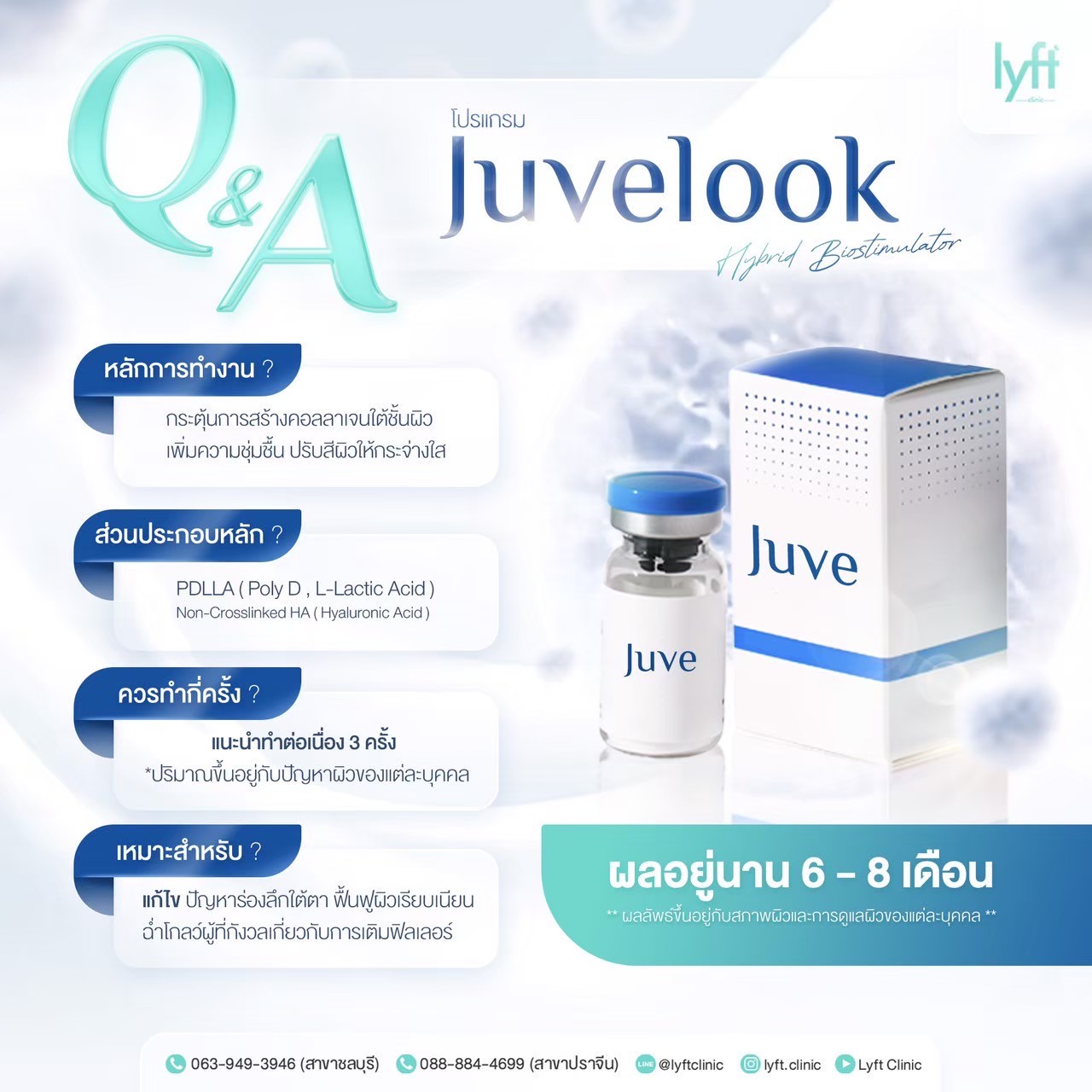 juvelook